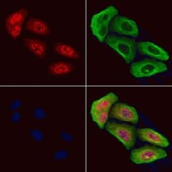 Invitrogen Phospho-HDAC4 (Ser632) Polyclonal Antibody 100 &mu;L; Unconjugated:Antibodies,