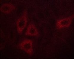 Invitrogen Phospho-Calmodulin 1/2/3 (Thr80, Ser82) Polyclonal Antibody