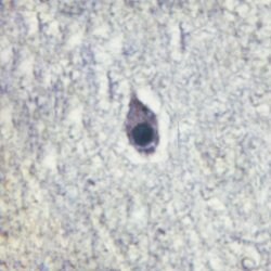 Invitrogen Phospho-Calmodulin 1/2/3 (Thr80, Ser82) Polyclonal Antibody