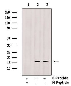 Invitrogen Phospho-Calmodulin 1/2/3 (Thr80, Ser82) Polyclonal Antibody