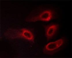 Phospho-14-3-3 zeta (Ser58) Polyclonal Antibody:Antibodies, Polyclonal