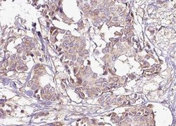 Phospho-14-3-3 zeta (Ser58) Polyclonal Antibody:Antibodies, Polyclonal