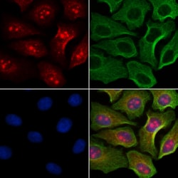 Invitrogen Phospho-Histone H3 (Ser11) Polyclonal Antibody 100 &mu;L; Unconjugated:Antibodies,