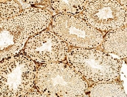 Invitrogen Phospho-Histone H3 (Ser11) Polyclonal Antibody 100 &mu;L; Unconjugated:Antibodies,