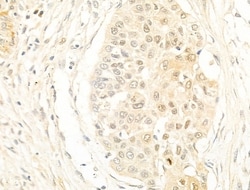 Invitrogen Phospho-Histone H3 (Ser11) Polyclonal Antibody 100 &mu;L; Unconjugated:Antibodies,