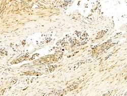 Invitrogen Phospho-Histone H3 (Ser11) Polyclonal Antibody 100 &mu;L; Unconjugated:Antibodies,