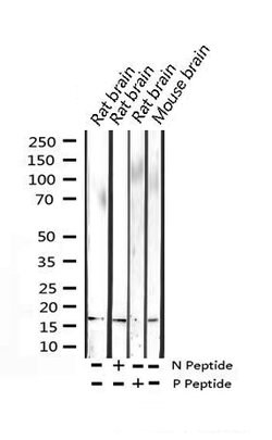 Invitrogen Phospho-Histone H3 (Ser11) Polyclonal Antibody 100 &mu;L; Unconjugated:Antibodies,