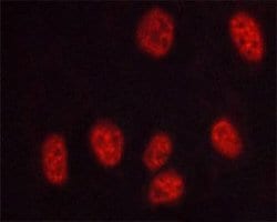 Invitrogen Phospho-DNA-PK (Thr2647) Polyclonal Antibody 100 μL; Unconjugated:Antibodies,