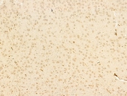 Invitrogen Phospho-Smad3 (Ser425) Polyclonal Antibody 100 &mu;L; Unconjugated:Antibodies,