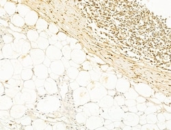 Invitrogen Phospho-Smad3 (Ser425) Polyclonal Antibody 100 &mu;L; Unconjugated:Antibodies,