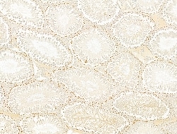 Invitrogen Phospho-Smad3 (Ser425) Polyclonal Antibody 100 &mu;L; Unconjugated:Antibodies,