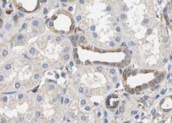 Invitrogen Phospho-Smad3 (Thr179) Polyclonal Antibody 100 &mu;L; Unconjugated:Antibodies,