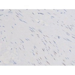 Invitrogen Phospho-Smad3 (Ser213) Polyclonal Antibody 100 &mu;L | Buy Online | Invitrogen&trade; | Fisher Scientific