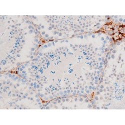 Invitrogen Phospho-Smad3 (Ser213) Polyclonal Antibody 100 &mu;L | Buy Online | Invitrogen&trade; | Fisher Scientific