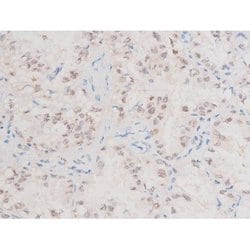 Invitrogen Phospho-XIAP (Ser87) Polyclonal Antibody 100 &mu;L; Unconjugated:Antibodies,