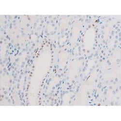 Invitrogen Phospho-FOXO4 (Thr451) Polyclonal Antibody 100 &mu;L; Unconjugated:Antibodies,