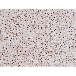 Invitrogen Phospho-FOXO4 (Thr451) Polyclonal Antibody 100 &mu;L; Unconjugated:Antibodies,