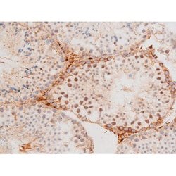 Invitrogen Phospho-FOXO4 (Thr451) Polyclonal Antibody 100 &mu;L; Unconjugated:Antibodies,