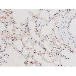 Invitrogen Phospho-FOXO4 (Thr451) Polyclonal Antibody 100 &mu;L; Unconjugated:Antibodies,