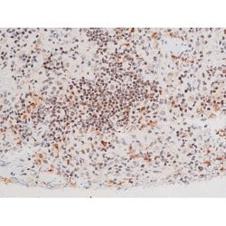Invitrogen Phospho-FOXO4 (Thr451) Polyclonal Antibody 100 &mu;L; Unconjugated:Antibodies,