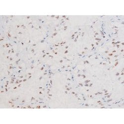 Invitrogen Phospho-FOXO4 (Thr451) Polyclonal Antibody 100 &mu;L; Unconjugated:Antibodies,