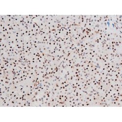 Invitrogen Phospho-FOXO4 (Thr451) Polyclonal Antibody 100 &mu;L; Unconjugated:Antibodies,