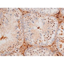 Invitrogen Phospho-FOXO4 (Thr451) Polyclonal Antibody 100 &mu;L; Unconjugated:Antibodies,