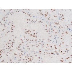 Invitrogen Phospho-FOXO4 (Thr451) Polyclonal Antibody 100 &mu;L; Unconjugated:Antibodies,