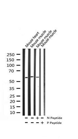 Invitrogen Phospho-FOXO4 (Thr451) Polyclonal Antibody 100 &mu;L; Unconjugated:Antibodies,