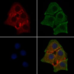 Invitrogen Phospho-CDK5 (Tyr15) Polyclonal Antibody 100 &mu;L | Buy Online | Invitrogen&trade; | Fisher Scientific