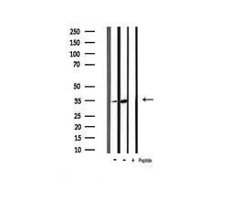 Invitrogen Phospho-CDK5 (Tyr15) Polyclonal Antibody 100 &mu;L | Buy Online | Invitrogen&trade; | Fisher Scientific