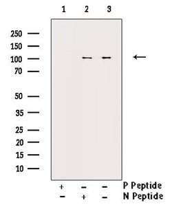 Invitrogen Phospho-NFkB p100 (Ser872) Polyclonal Antibody 100 &mu;L; Unconjugated:Antibodies,
