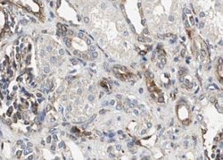 Invitrogen Phospho-RelB (Ser573) Polyclonal Antibody 100 &mu;L | Buy Online | Invitrogen&trade; | Fisher Scientific
