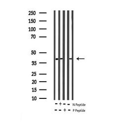 Invitrogen Phospho-MEK1 (Thr292) Polyclonal Antibody 100 &mu;L; Unconjugated:Antibodies,