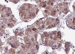 Invitrogen Phospho-MAP2K1/MAP2K2 (Ser218) Polyclonal Antibody 100 &mu;L;
