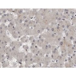 Phospho-MAP2K1/MAP2K2 (Ser222) Polyclonal Antibody, Invitrogen 100 &mu;L;