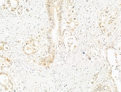 Invitrogen Phospho-NFkB p65 (Ser276) Polyclonal Antibody 100 &mu;L; Unconjugated:Antibodies,