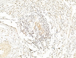 Invitrogen Phospho-NFkB p65 (Ser276) Polyclonal Antibody 100 &mu;L; Unconjugated:Antibodies,