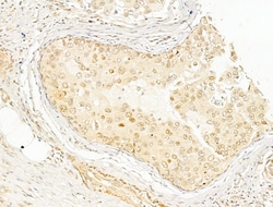 Invitrogen Phospho-NFkB p65 (Ser276) Polyclonal Antibody 100 &mu;L; Unconjugated:Antibodies,