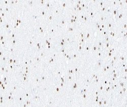 Invitrogen Phospho-NFkB p65 (Ser276) Polyclonal Antibody 100 &mu;L; Unconjugated:Antibodies,