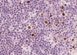Invitrogen Phospho-NFkB p65 (Ser311) Polyclonal Antibody 100 &mu;L; Unconjugated:Antibodies,