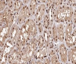 Invitrogen Phospho-NFkB p65 (Thr254) Polyclonal Antibody 100 &mu;L; Unconjugated:Antibodies,