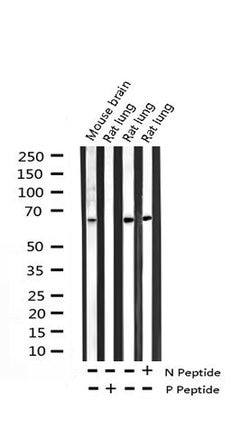 Invitrogen Phospho-NFkB p65 (Thr254) Polyclonal Antibody 100 &mu;L; Unconjugated:Antibodies,