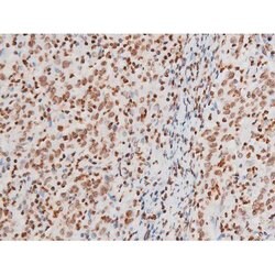 Invitrogen Phospho-NFkB p65 (Thr435) Polyclonal Antibody 100 &mu;L | Buy Online | Invitrogen&trade; | Fisher Scientific