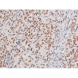 Invitrogen Phospho-NFkB p65 (Thr435) Polyclonal Antibody 100 &mu;L | Buy Online | Invitrogen&trade; | Fisher Scientific