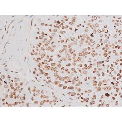 Invitrogen Phospho-NFkB p65 (Thr435) Polyclonal Antibody 100 &mu;L | Buy Online | Invitrogen&trade; | Fisher Scientific