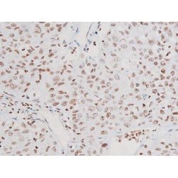 Invitrogen Phospho-NFkB p65 (Thr435) Polyclonal Antibody 100 &mu;L | Buy Online | Invitrogen&trade; | Fisher Scientific