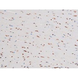 Invitrogen Phospho-NFkB p65 (Thr435) Polyclonal Antibody 100 &mu;L | Buy Online | Invitrogen&trade; | Fisher Scientific