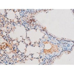 Invitrogen Phospho-NFkB p65 (Thr435) Polyclonal Antibody 100 &mu;L | Buy Online | Invitrogen&trade; | Fisher Scientific