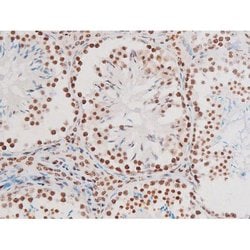 Invitrogen Phospho-NFkB p65 (Thr435) Polyclonal Antibody 100 &mu;L | Buy Online | Invitrogen&trade; | Fisher Scientific
